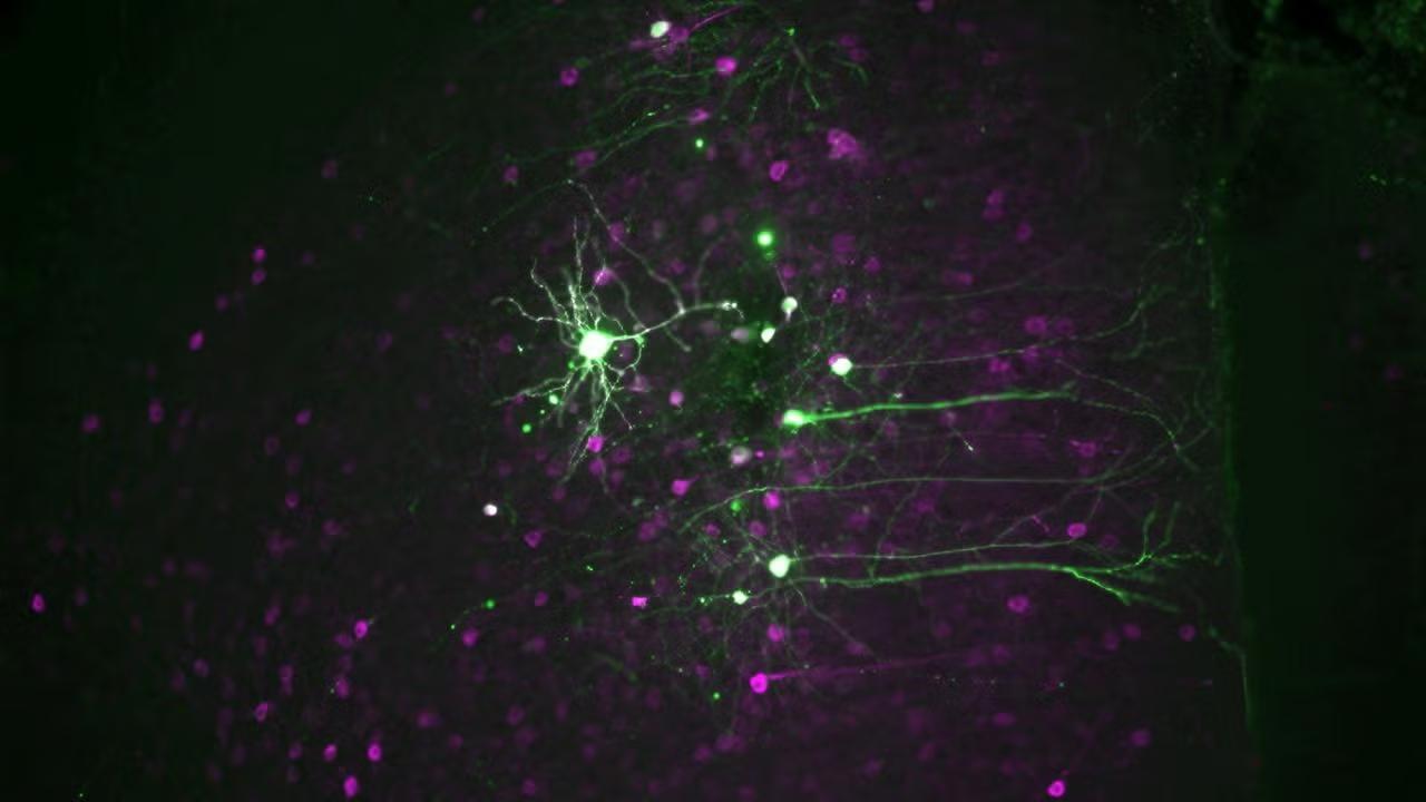 brain cells activated by psychedelic drug