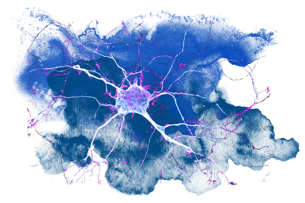 neuron treated with ibogaine