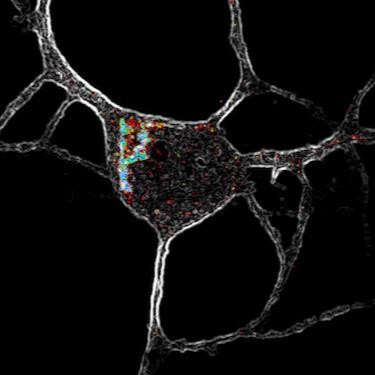 Close-up image of a 5-HT2A neuron.