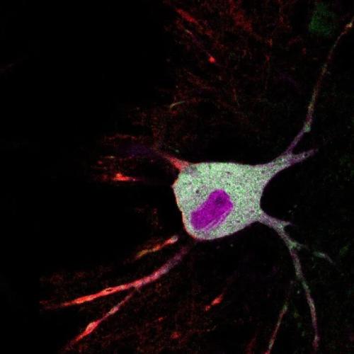 neuron imaged using CaST tool