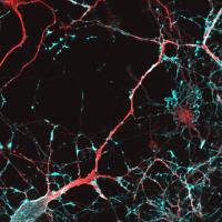 ibogaine treated neuron colored red and green, black background