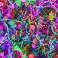 Scanning electron micrograph of human brain cells
