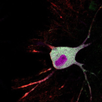 Neuron imaged using CaST tool