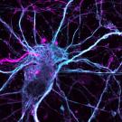 neuron treated with ibogaine