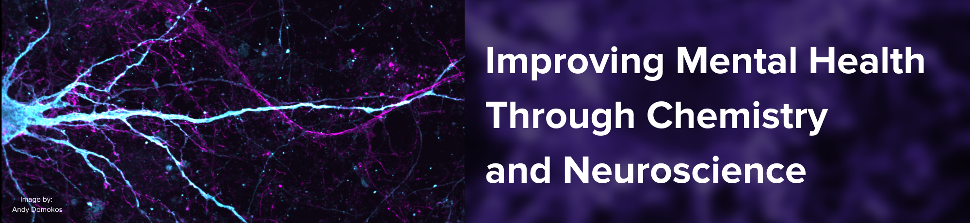 neuron stretching from left to right on the screen